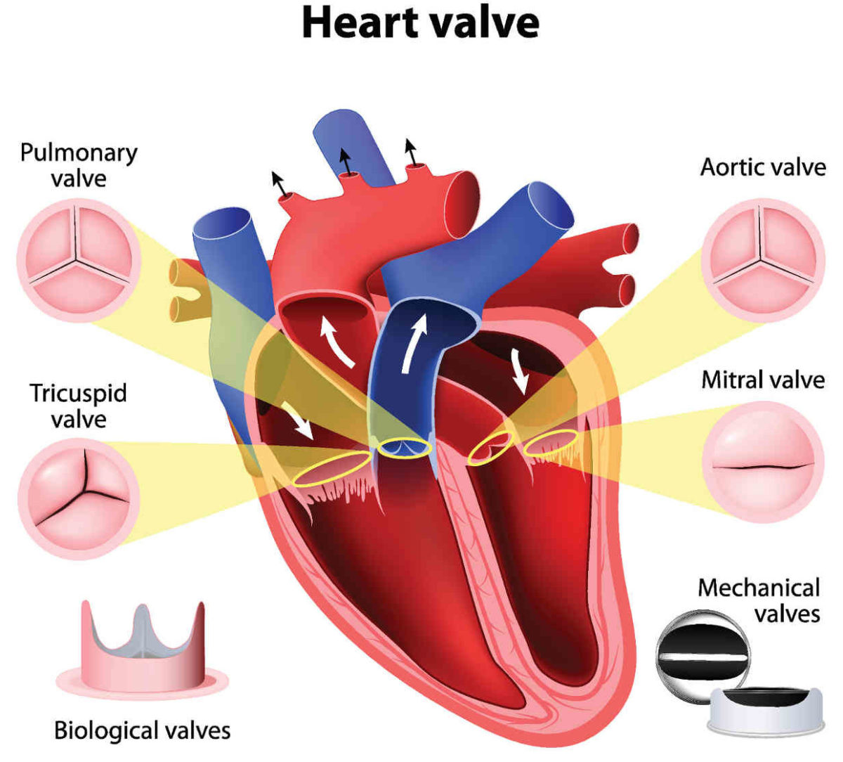 recovery after aortic valve surgery