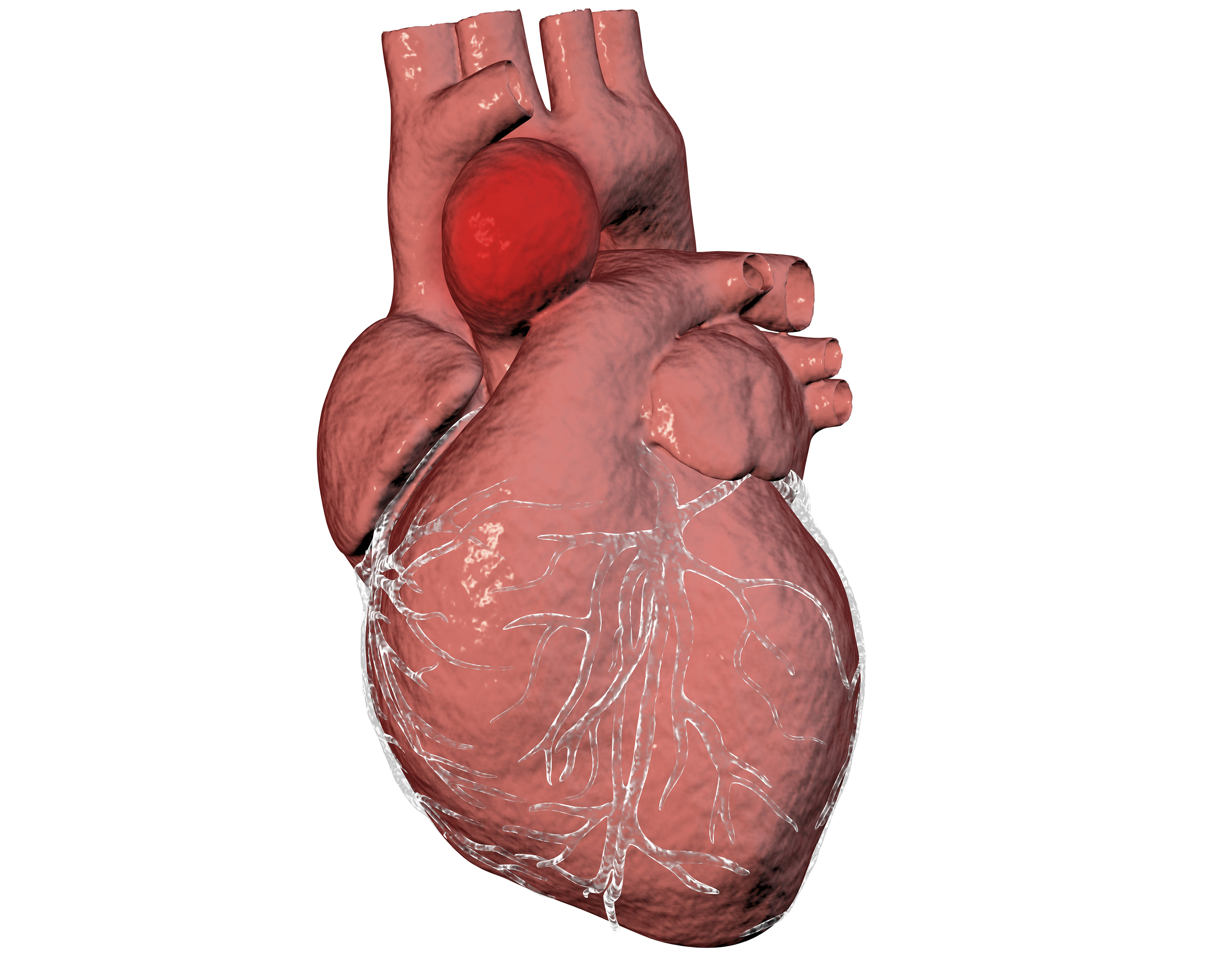 aortic-aneurysm-and-heart-disease-dr-peter-mikhail